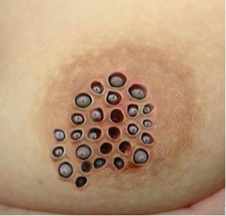 恶心的图片,揭秘那些令人作呕的图片背后的真相